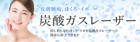 炭酸ガスレーザー