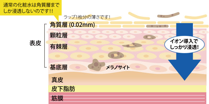 イオン導入器の図