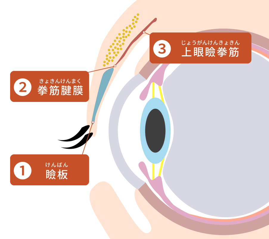 眼瞼下垂の原因
