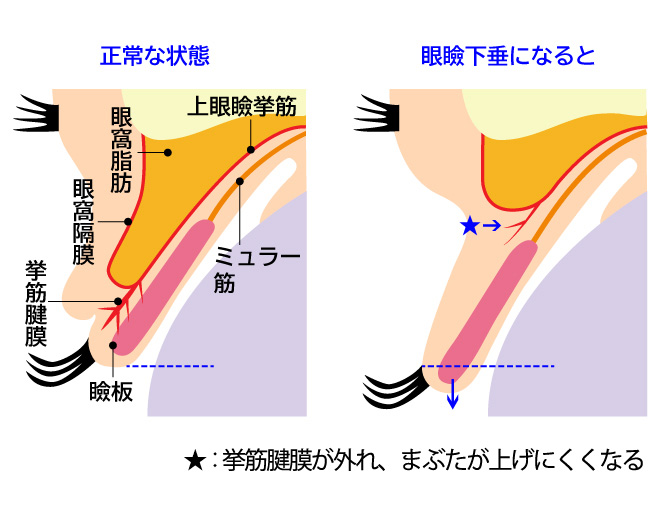 眼瞼構造